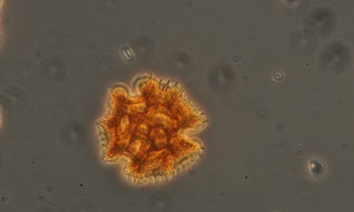 CichorioideaePollen